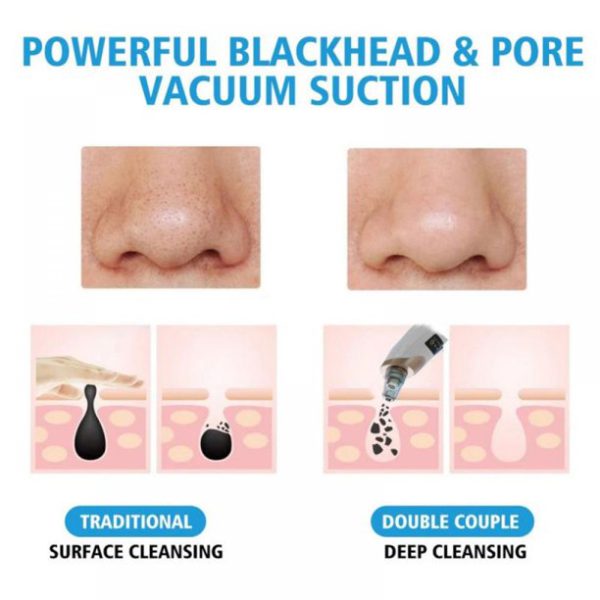 Electric Blackhead Pore Cleaning Suction